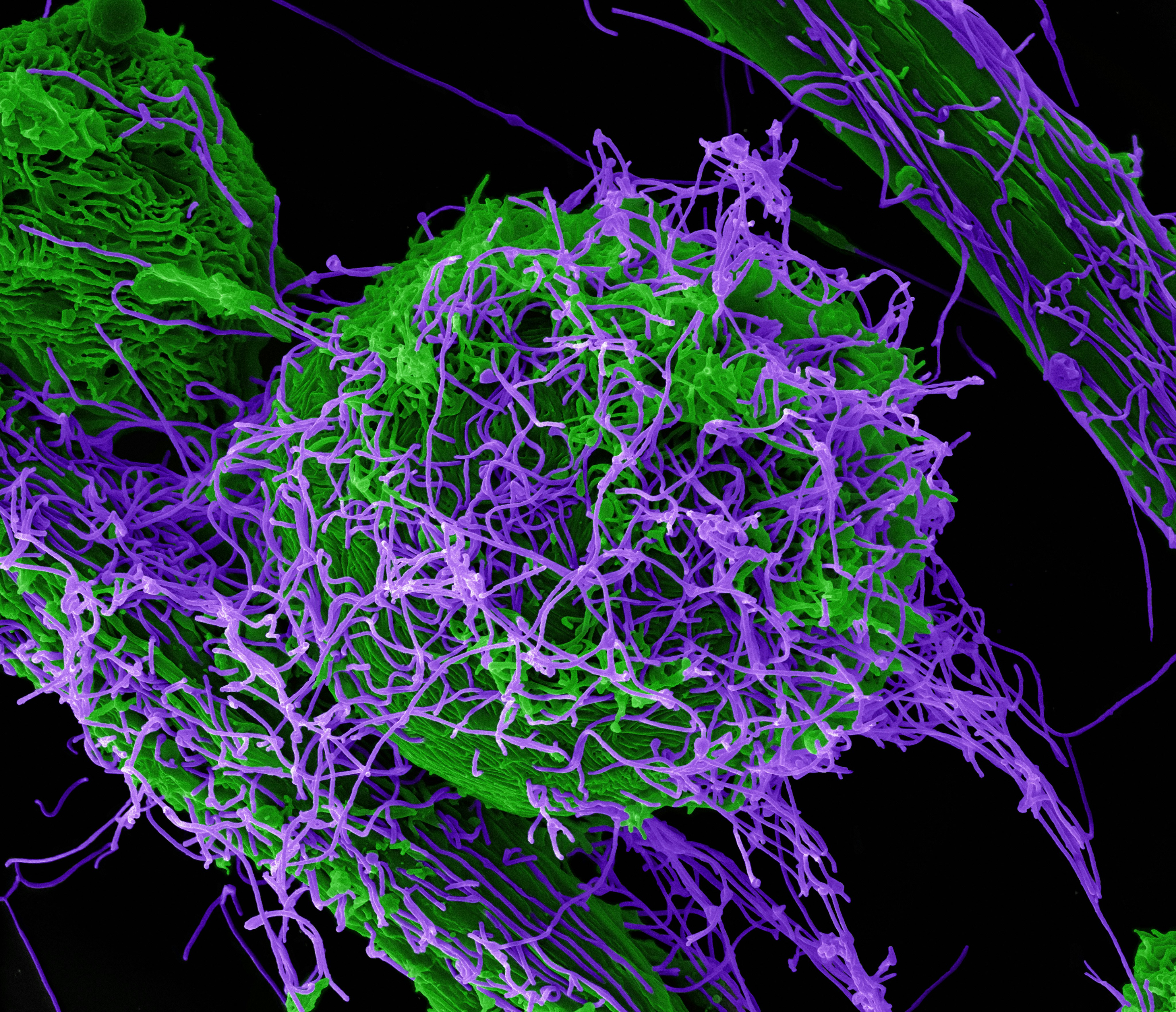 A microscopic view of an Ebola Virus 